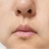 방지 패치24p 팔자개선 관리 팔자 소품 뷰티