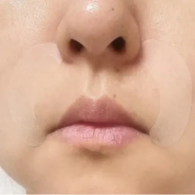방지 패치24p 팔자개선 관리 팔자 소품 뷰티