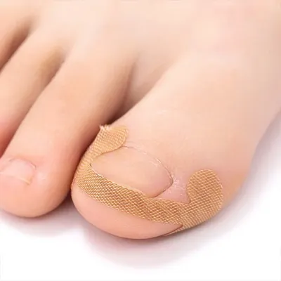 부드러운 손톱 발톱 스티커 발가락 보호패치 테이프