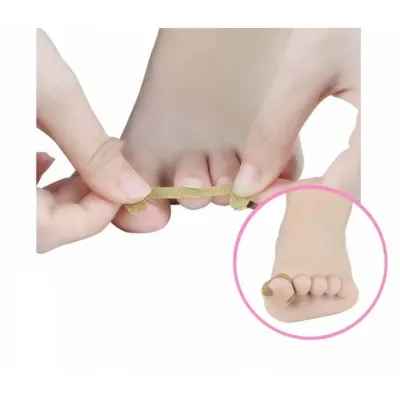 프롬아떼 내성발톱 파고드는 발톱 패치 발가락보호 테이핑밴드 셀프케어 발톱관리 내향성발톱 관리 40P