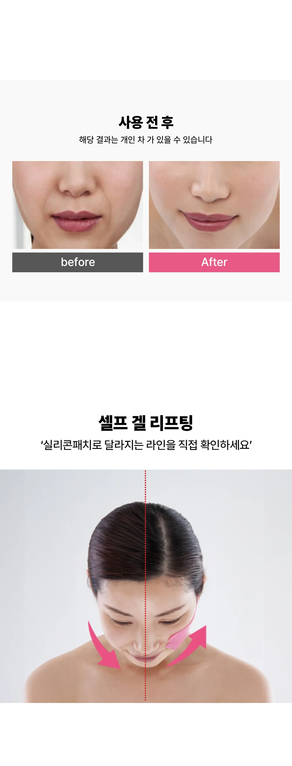 루미나D 겔패치 101312 치크 페이스리프팅 얼굴 관리 홈케어 뷰티용품 상세4