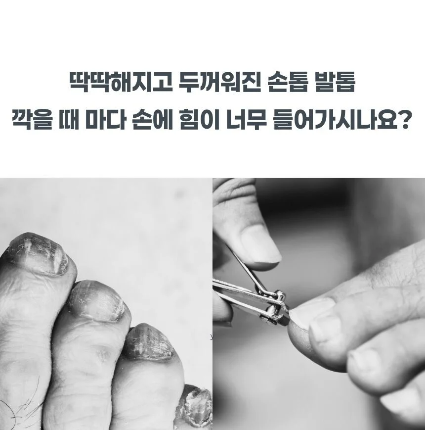 두꺼운 발톱깎이 고강도 손톱깎이 와이드날 케이스포함 상세2