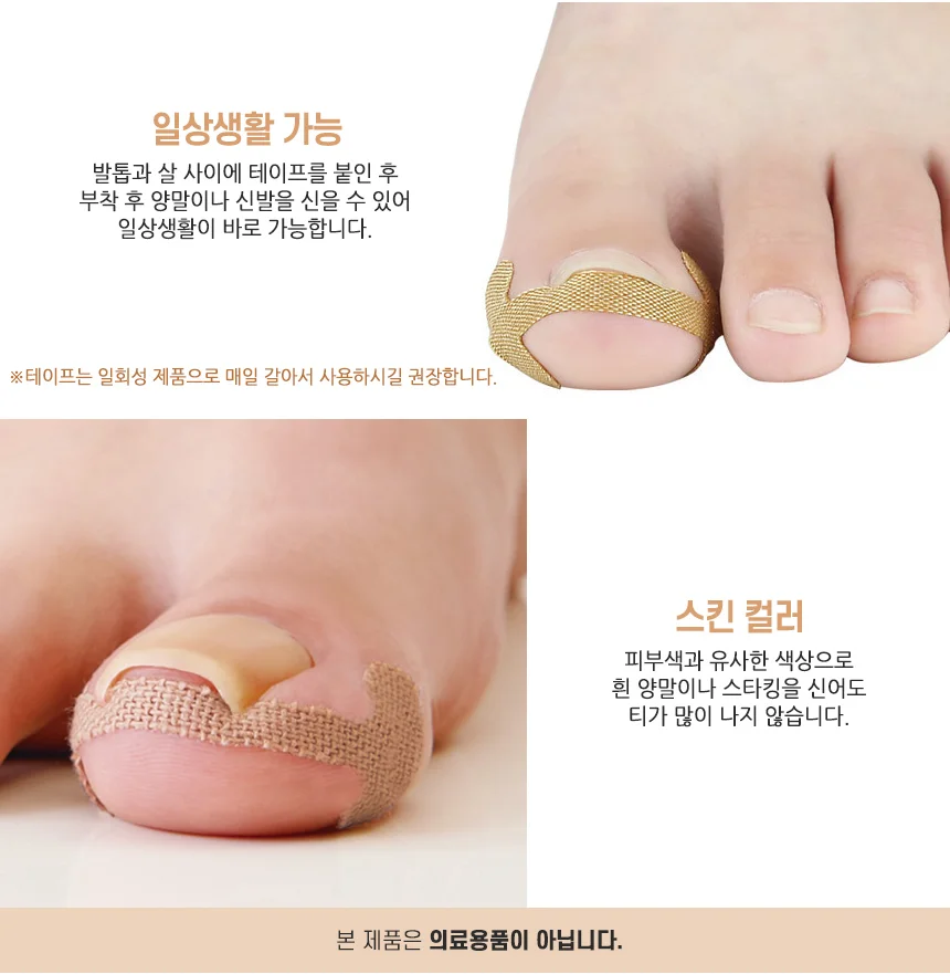 내성발톱방지테이프 보호테이프 발톱관리도구 상세3