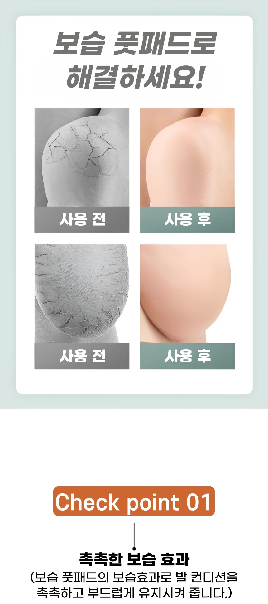 보습 풋패드 뒤꿈치 패드 각질 굳은살 관리 발꿈치 보습 보호패드 2P 상세3