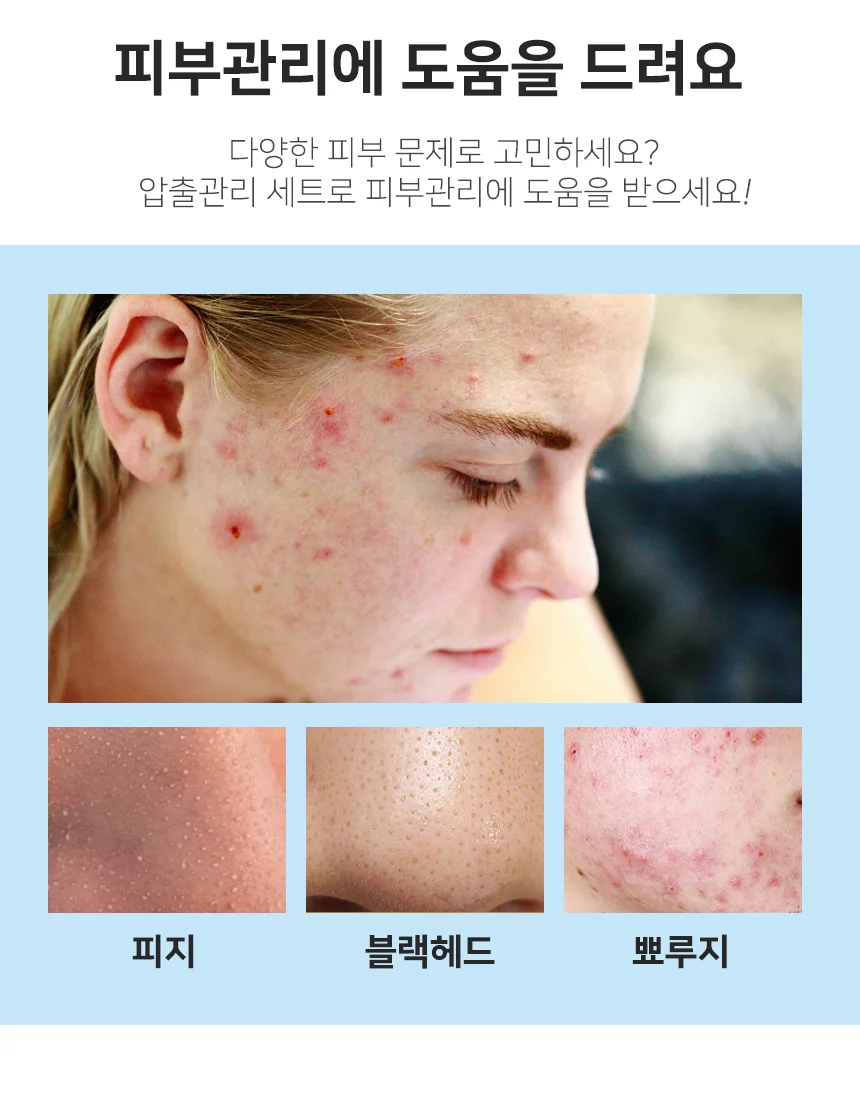 8종세트 도구 압출 피부 블랙헤드제거 청소 블랙헤드 압출 여드름 상세2