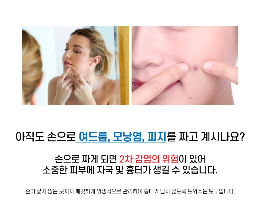 피지 제거기 스틱 블랙헤드스틱 핀셋 여드름압출기 피지제거기 블랙헤드제거 상세2